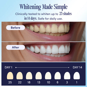 Teeth Whitening U-wraps